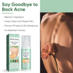 Back Acne Treatment Spray-5